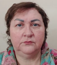 Больному с альцгеймером - Зоткина Ольга Степановна